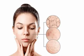 types de peau